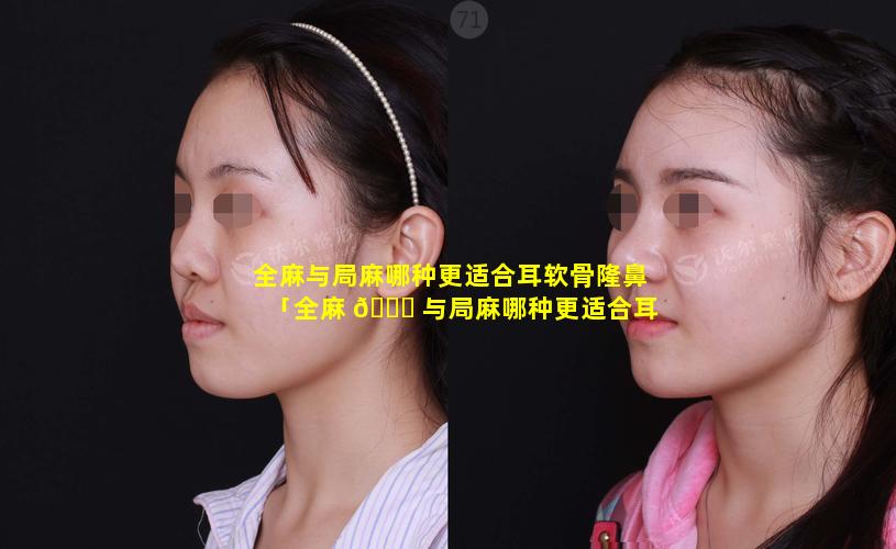 全麻与局麻哪种更适合耳软骨隆鼻「全麻 🐈 与局麻哪种更适合耳软骨隆鼻手术」